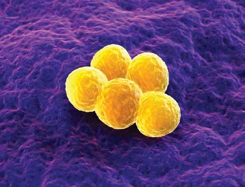 MRSA
