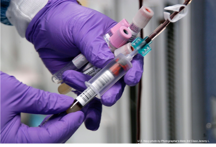 HIV testing